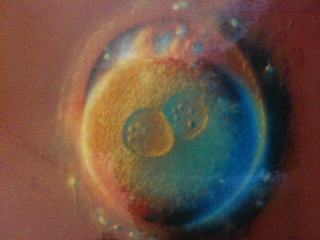 Photo2